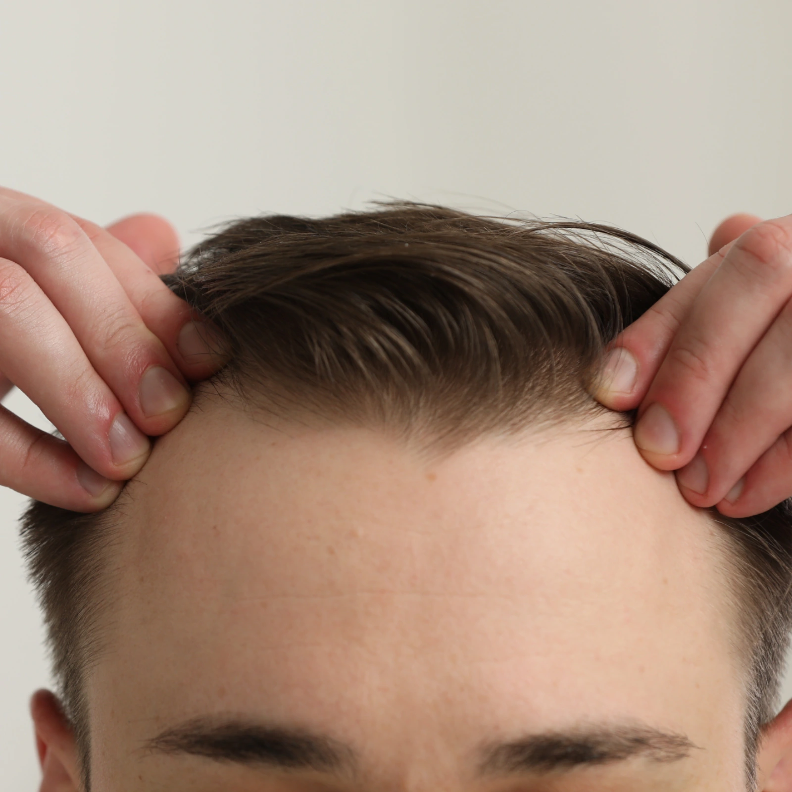 Hair Regrowth for Men