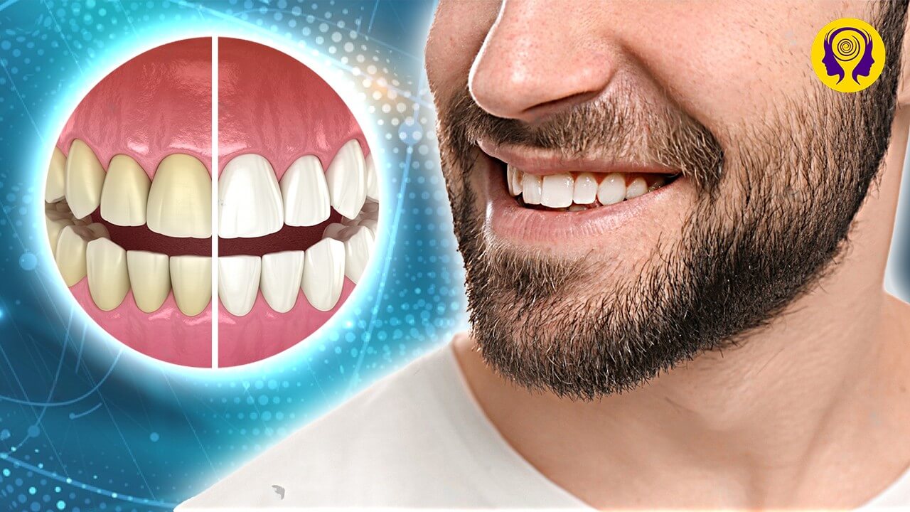 Hollywood Smile